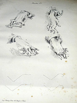 Figure 2 : Un feuillet préparatoire à la thèse de médecine de Jean-Martin Charcot datant de 1853 et réalisé à l’encre. © Musée de l’AP-HP/ Photo : HCS