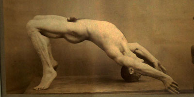 Figure 6 : Photographie d’A. Londe, non datée, représentant un opisthotonos (contracture généralisée des muscles) durant une grande crise hystérique (©Musée de l’AP-HP/ Photo : HCS)